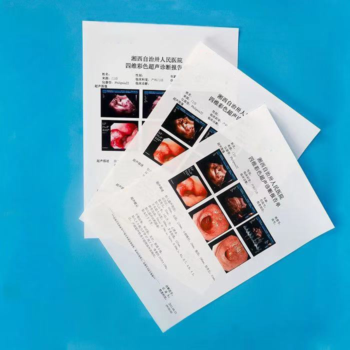 PACS 超声诊断报告胶片